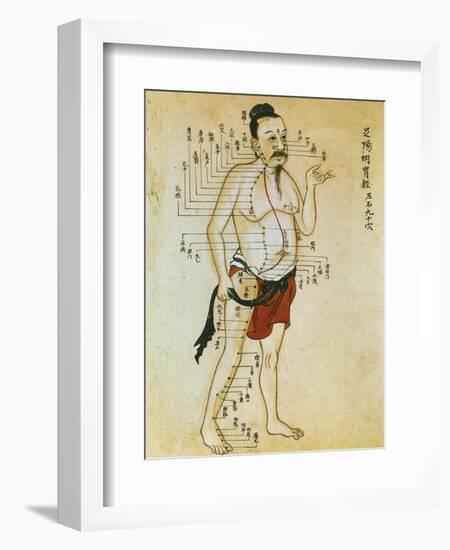 Chinese Acupuncture Charts-null-Framed Art Print