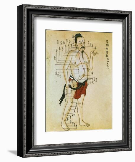 Chinese Acupuncture Charts-null-Framed Art Print