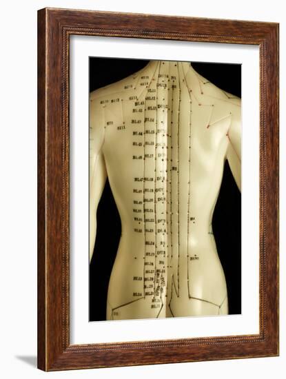 Chinese Acupuncture Model-Doncaster and Bassetlaw-Framed Photographic Print