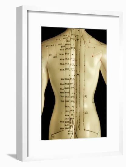 Chinese Acupuncture Model-Doncaster and Bassetlaw-Framed Photographic Print