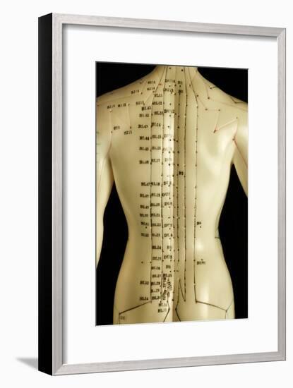 Chinese Acupuncture Model-Doncaster and Bassetlaw-Framed Photographic Print