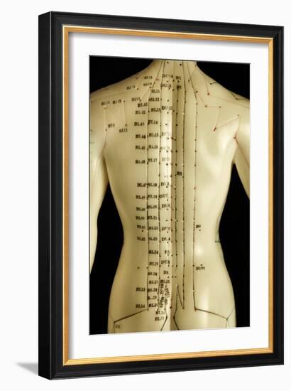 Chinese Acupuncture Model-Doncaster and Bassetlaw-Framed Photographic Print