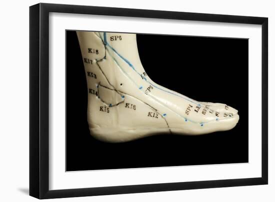 Chinese Acupuncture Model-Doncaster and Bassetlaw-Framed Photographic Print