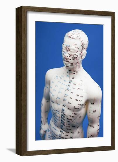 Chinese Acupuncture Model-null-Framed Photographic Print