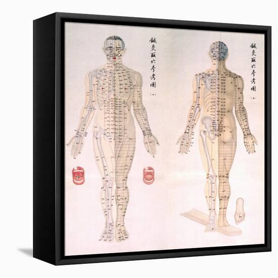 Chinese Chart of Acupuncture Points on a Male Body, 1956-null-Framed Stretched Canvas