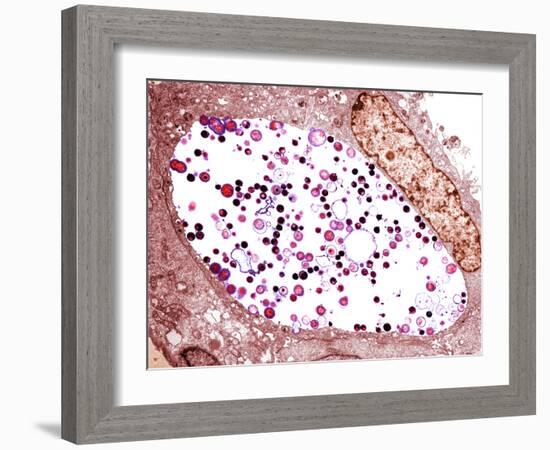 Chlamydia Trachomatis Bacteria, TEM-Biomedical Imaging-Framed Photographic Print