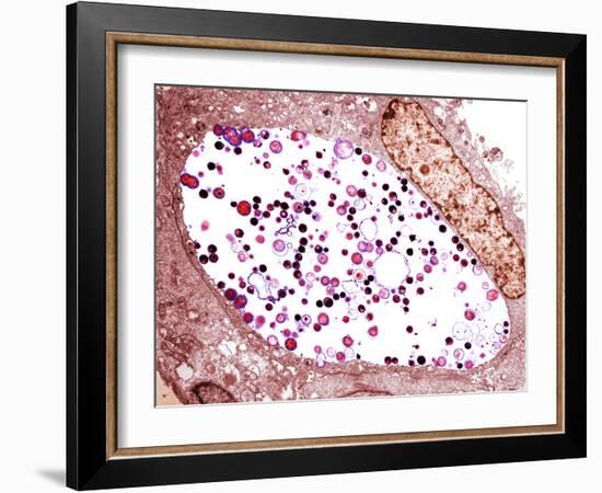 Chlamydia Trachomatis Bacteria, TEM-Biomedical Imaging-Framed Photographic Print