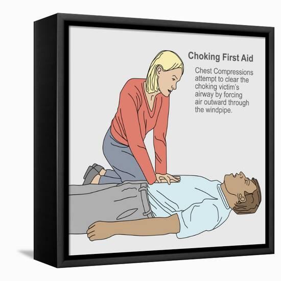 Choking First Aid-Gwen Shockey-Framed Premier Image Canvas