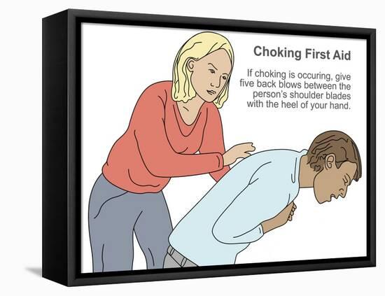 Choking First Aid-Gwen Shockey-Framed Premier Image Canvas