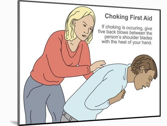 Choking First Aid-Gwen Shockey-Mounted Giclee Print