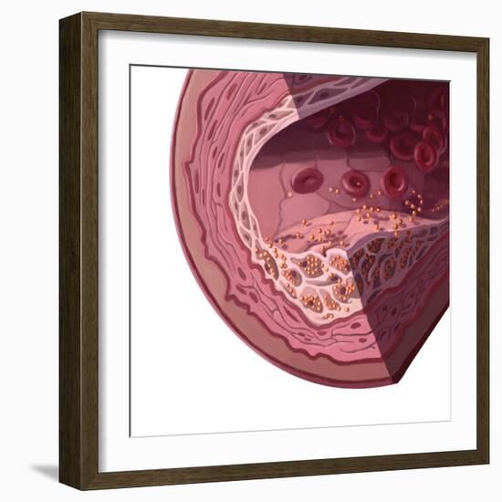 Cholesterol-Spencer Sutton-Framed Giclee Print