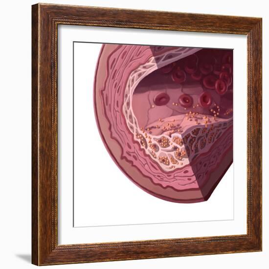 Cholesterol-Spencer Sutton-Framed Giclee Print