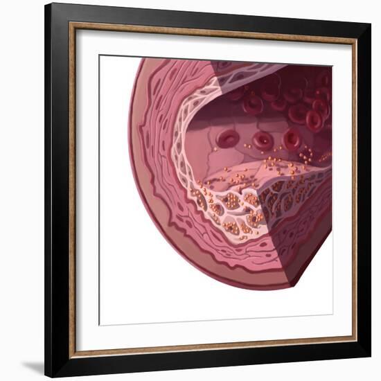 Cholesterol-Spencer Sutton-Framed Giclee Print