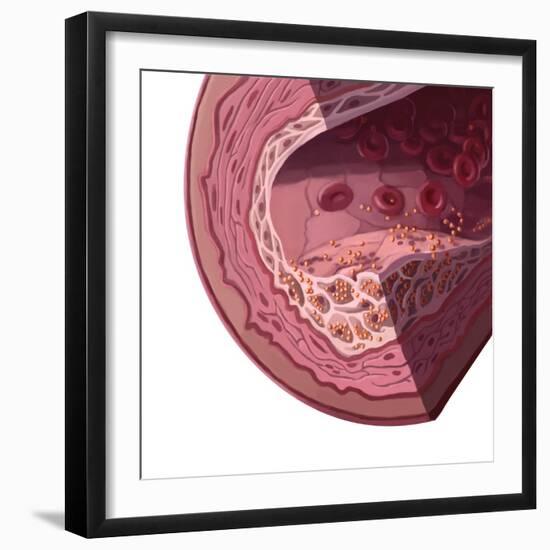 Cholesterol-Spencer Sutton-Framed Giclee Print