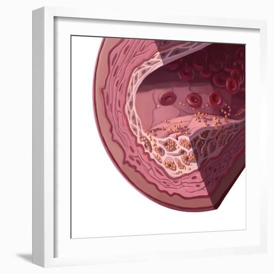 Cholesterol-Spencer Sutton-Framed Giclee Print