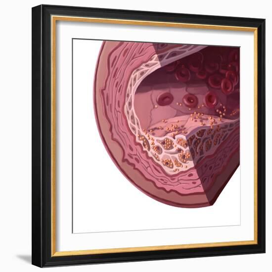 Cholesterol-Spencer Sutton-Framed Giclee Print