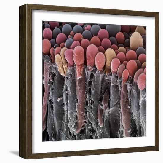 Choroid Plexus Secretory Cells, SEM-Steve Gschmeissner-Framed Premium Photographic Print