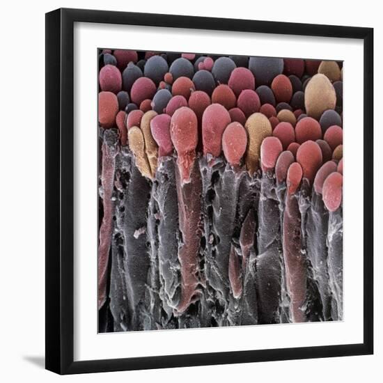 Choroid Plexus Secretory Cells, SEM-Steve Gschmeissner-Framed Premium Photographic Print