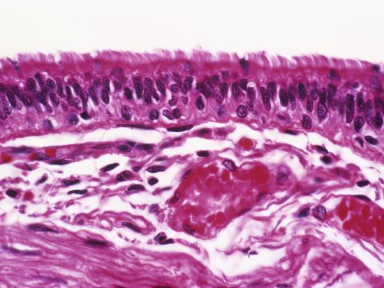 ciliated pseudostratified columnar epithelium
