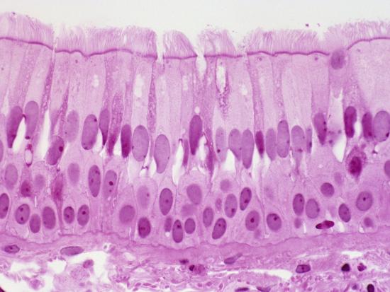 ciliated pseudostratified columnar epithelium