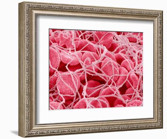 Coagulated Red Blood Cells-Micro Discovery-Framed Photographic Print