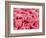 Coagulated Red Blood Cells-Micro Discovery-Framed Photographic Print