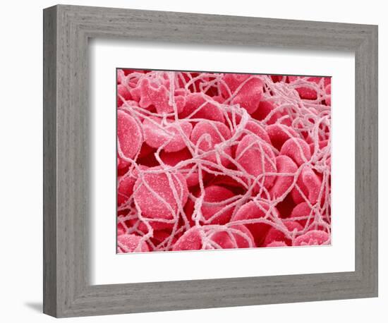 Coagulated Red Blood Cells-Micro Discovery-Framed Photographic Print