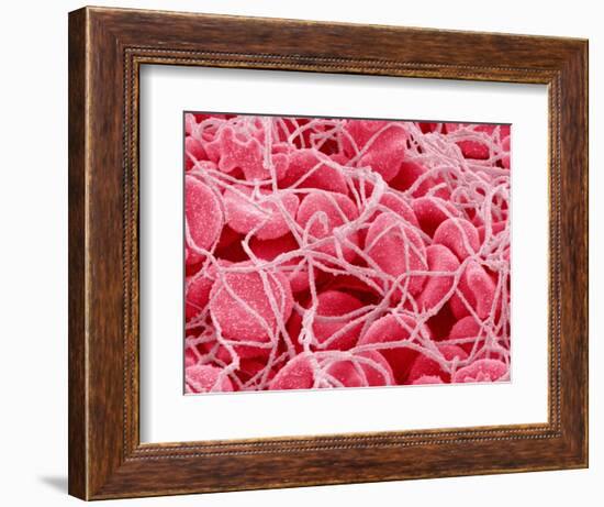 Coagulated Red Blood Cells-Micro Discovery-Framed Photographic Print