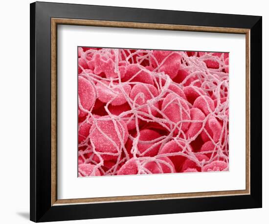 Coagulated Red Blood Cells-Micro Discovery-Framed Photographic Print