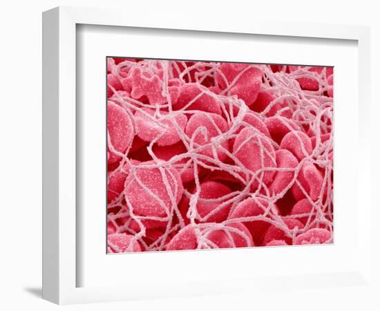 Coagulated Red Blood Cells-Micro Discovery-Framed Photographic Print