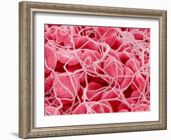 Coagulated Red Blood Cells-Micro Discovery-Framed Photographic Print