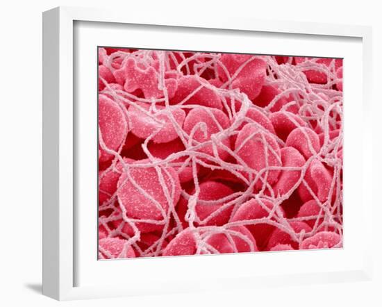 Coagulated Red Blood Cells-Micro Discovery-Framed Photographic Print