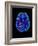 Col. MRI Scan of a Brain with Multiple Sclerosis-Science Photo Library-Framed Photographic Print