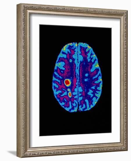 Col. MRI Scan of a Brain with Multiple Sclerosis-Science Photo Library-Framed Photographic Print