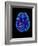 Col. MRI Scan of a Brain with Multiple Sclerosis-Science Photo Library-Framed Photographic Print