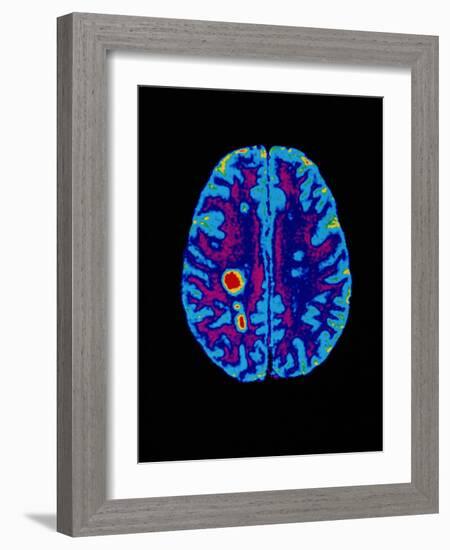 Col. MRI Scan of a Brain with Multiple Sclerosis-Science Photo Library-Framed Photographic Print