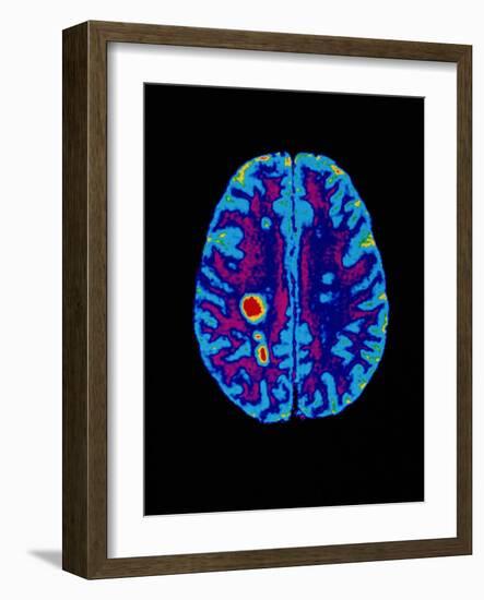 Col. MRI Scan of a Brain with Multiple Sclerosis-Science Photo Library-Framed Photographic Print