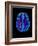 Col. MRI Scan of a Brain with Multiple Sclerosis-Science Photo Library-Framed Photographic Print