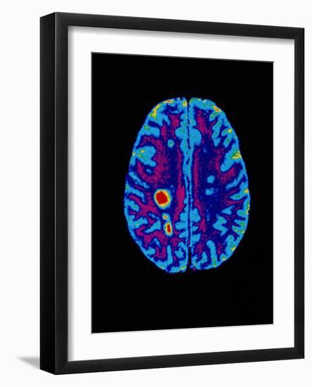 Col. MRI Scan of a Brain with Multiple Sclerosis-Science Photo Library-Framed Photographic Print