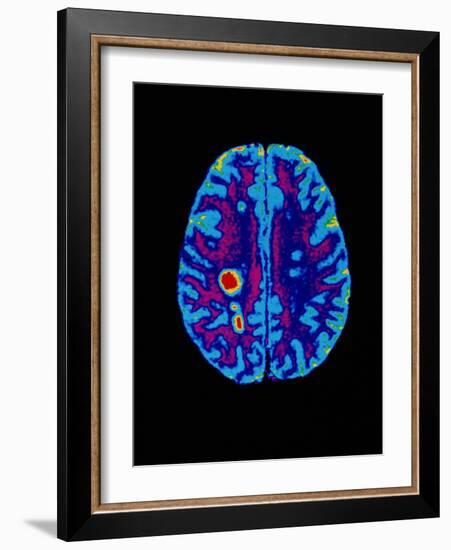 Col. MRI Scan of a Brain with Multiple Sclerosis-Science Photo Library-Framed Photographic Print