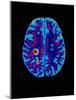 Col. MRI Scan of a Brain with Multiple Sclerosis-Science Photo Library-Mounted Photographic Print