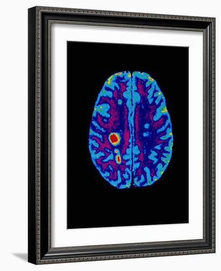 Col. MRI Scan of a Brain with Multiple Sclerosis-Science Photo Library-Framed Photographic Print