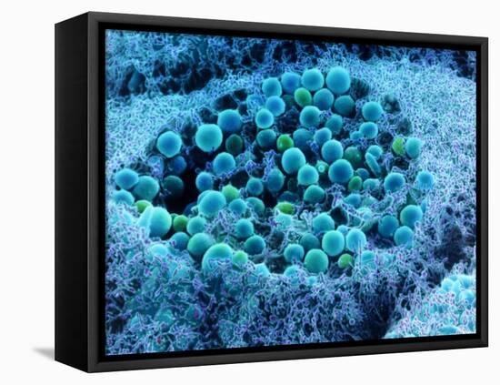 Col. SEM of Eye Melanocyte Cell & Pigment Granules-Steve Gschmeissner-Framed Premier Image Canvas