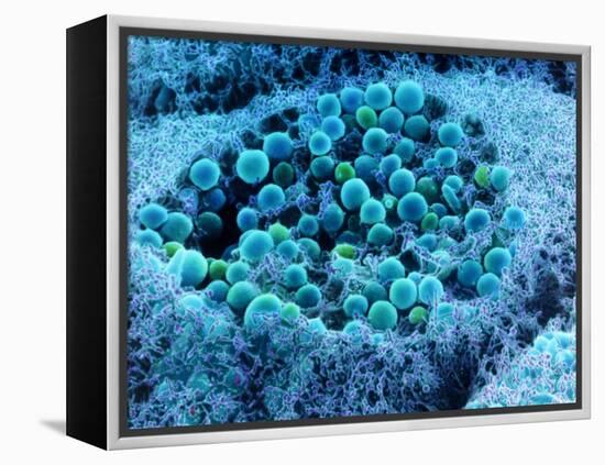 Col. SEM of Eye Melanocyte Cell & Pigment Granules-Steve Gschmeissner-Framed Premier Image Canvas