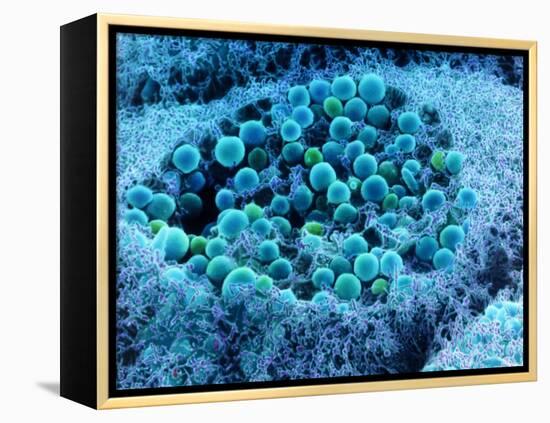 Col. SEM of Eye Melanocyte Cell & Pigment Granules-Steve Gschmeissner-Framed Premier Image Canvas
