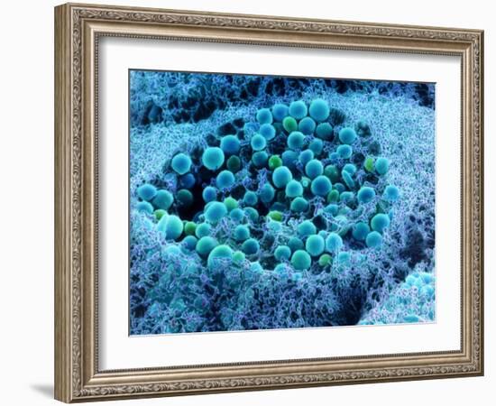 Col. SEM of Eye Melanocyte Cell & Pigment Granules-Steve Gschmeissner-Framed Photographic Print