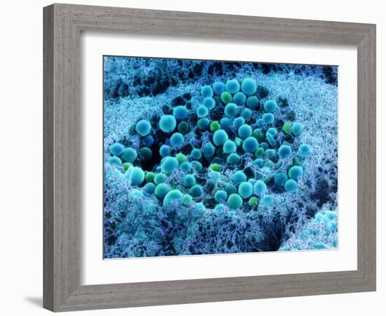 Col. SEM of Eye Melanocyte Cell & Pigment Granules-Steve Gschmeissner-Framed Photographic Print