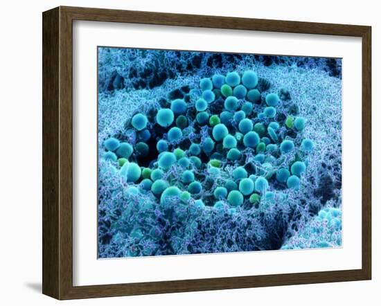 Col. SEM of Eye Melanocyte Cell & Pigment Granules-Steve Gschmeissner-Framed Photographic Print