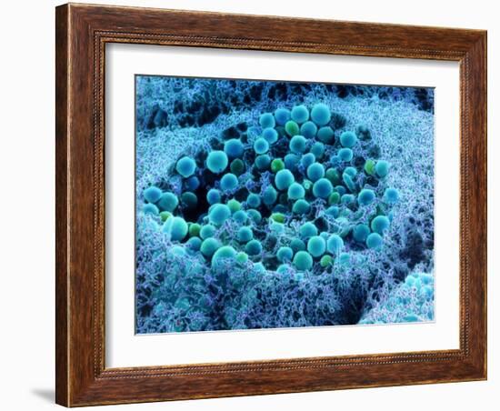 Col. SEM of Eye Melanocyte Cell & Pigment Granules-Steve Gschmeissner-Framed Photographic Print