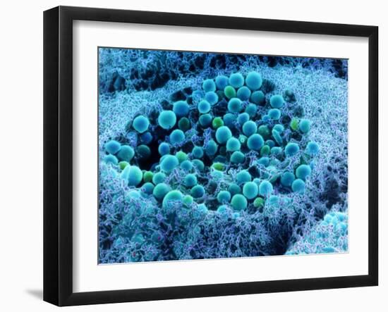 Col. SEM of Eye Melanocyte Cell & Pigment Granules-Steve Gschmeissner-Framed Photographic Print